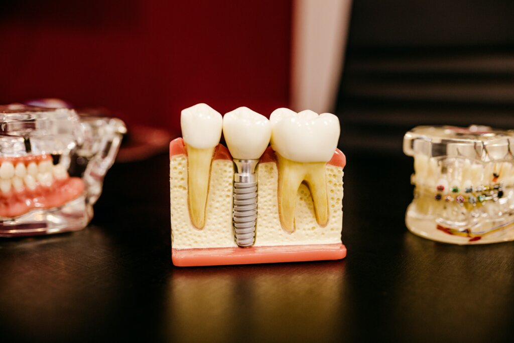 치아 건강을 위한 연령대별 관리방법과 나의 견해